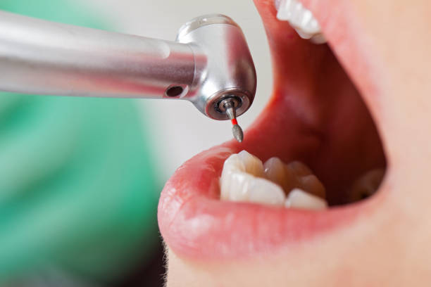 Best Pediatric Emergency Dentist in Fairfield, OH